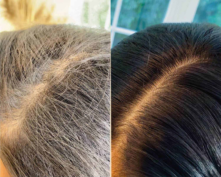 Shampoo Renascer PRO NOVA